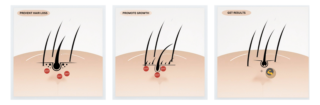 How does Finasteride work